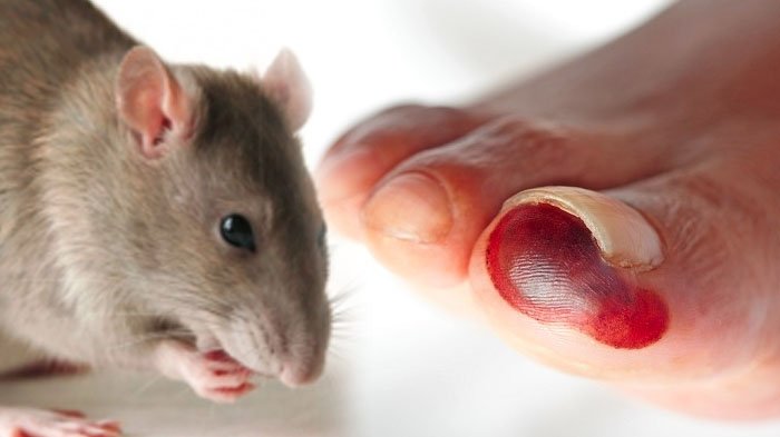 Penyebab penyakit PES! - PT Mahaka Improcare Indonesia